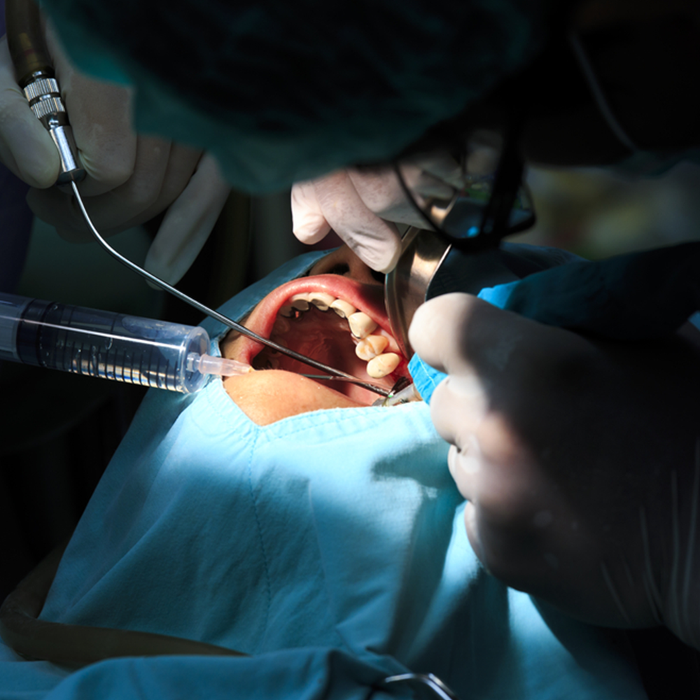 Oral and Maxillofacial Surgery in Iran