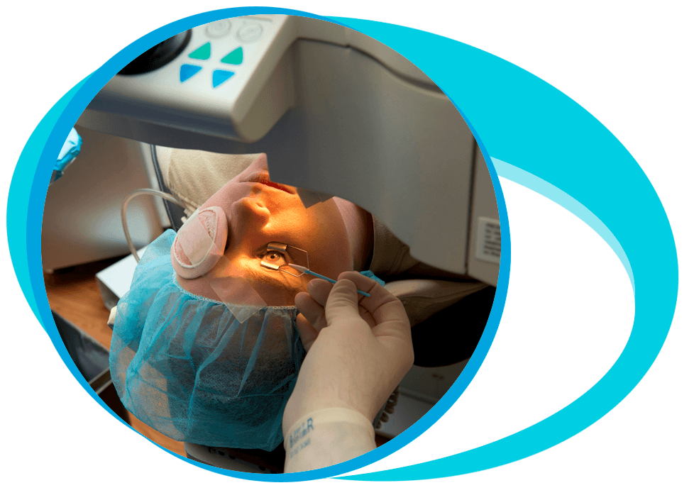 Refractive Surgery in Iran