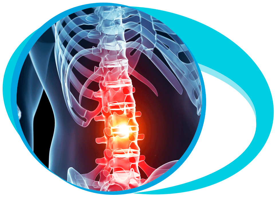 Spinal Cord Injury Treatment in Iran