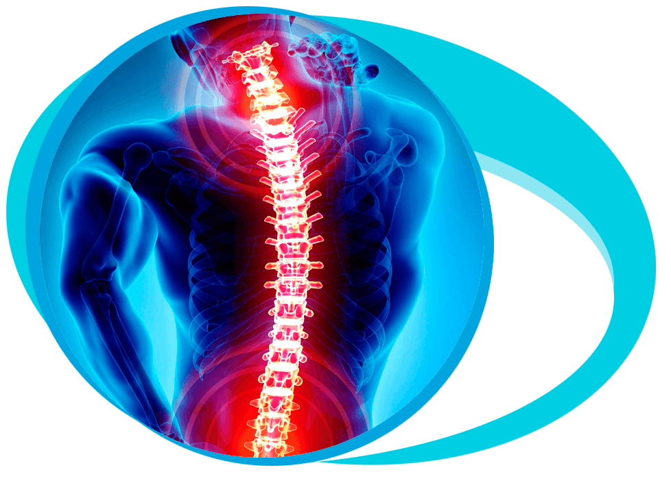 Spinal Laminectomy in Iran