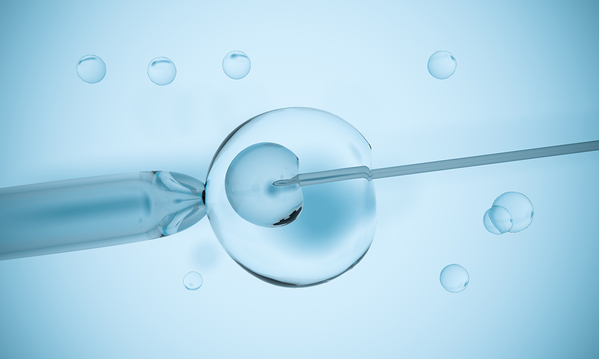 Assisted Reproductive Technology (ART) in Iran