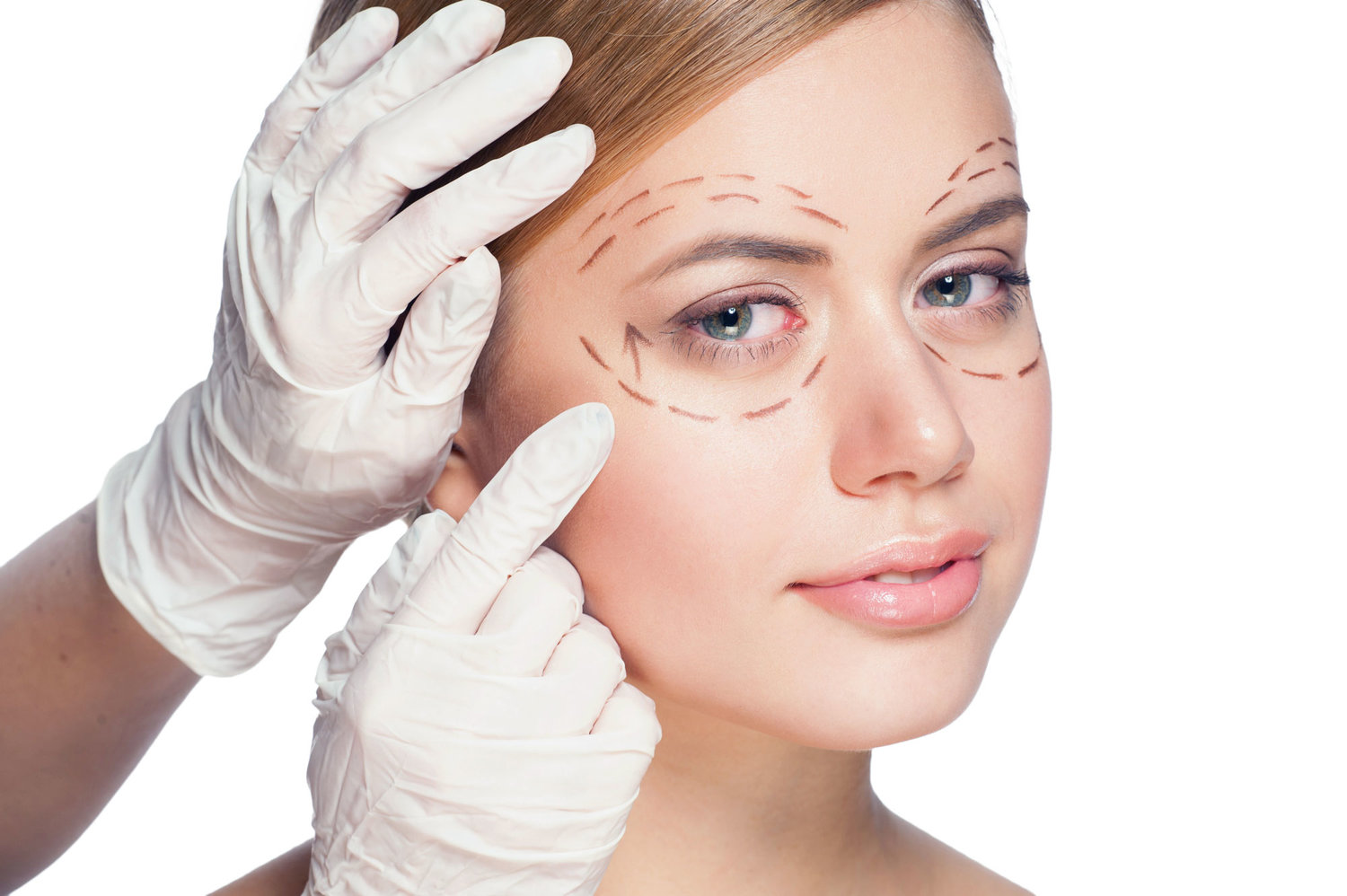 Cosmetic Eye Surgery in Iran