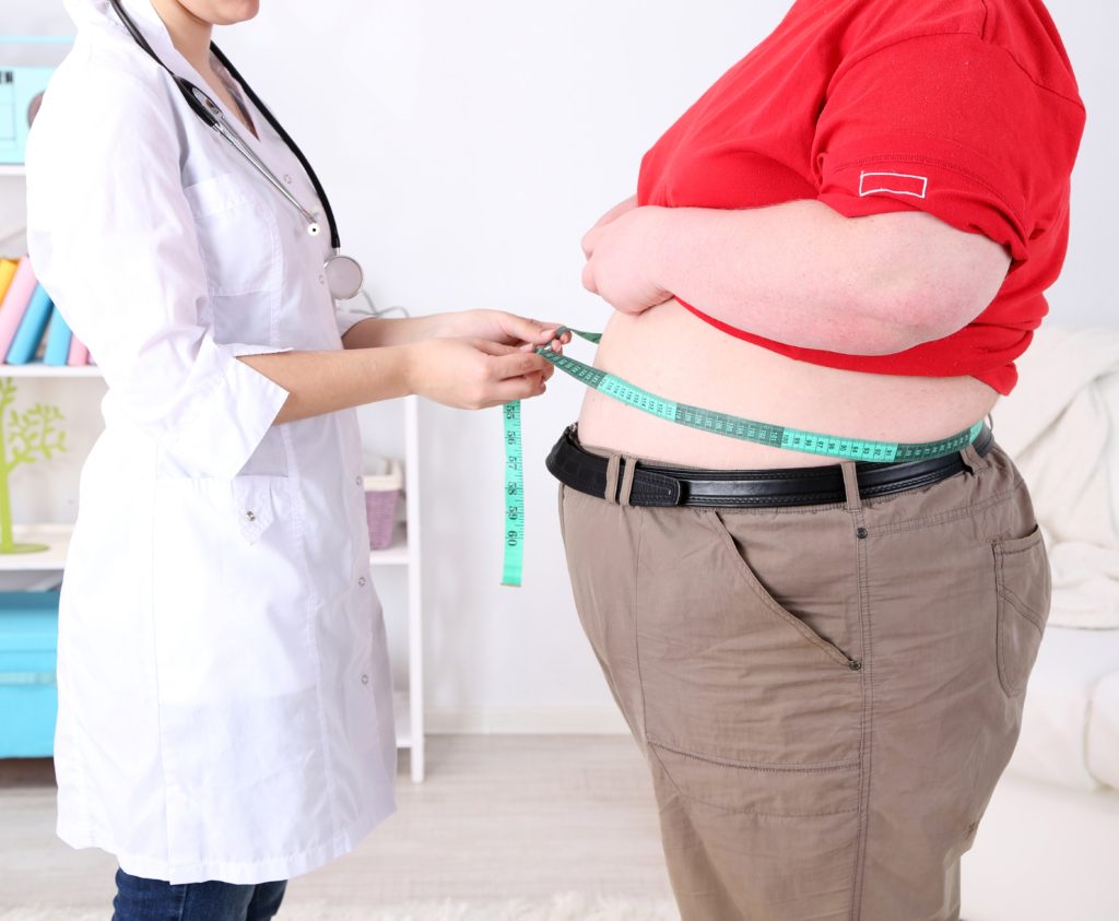 Gastric Bypass in Iran