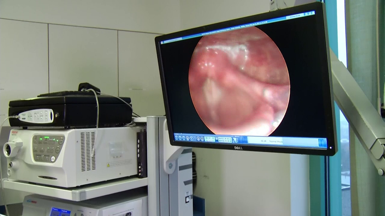 Laser Vocal Cord Surgery in Iran