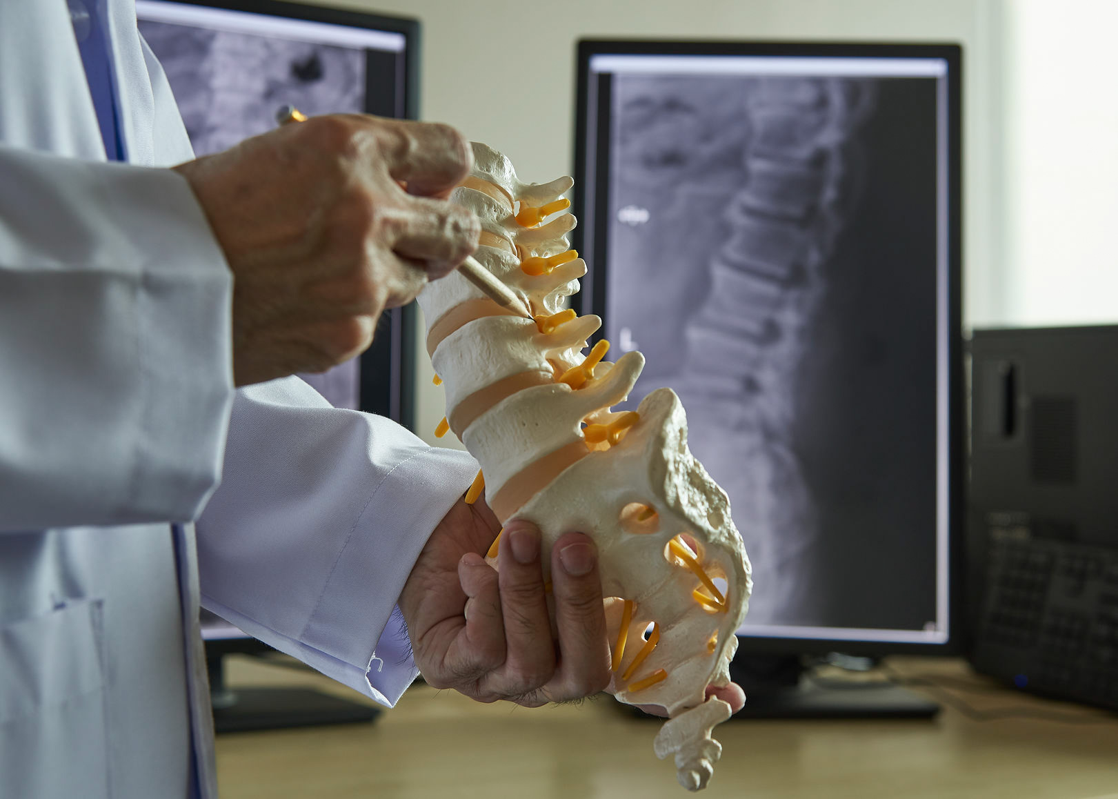 Lumbar Spinal Stenosis Surgery in Iran