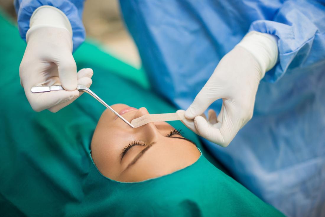 Nasal Surgery in Iran