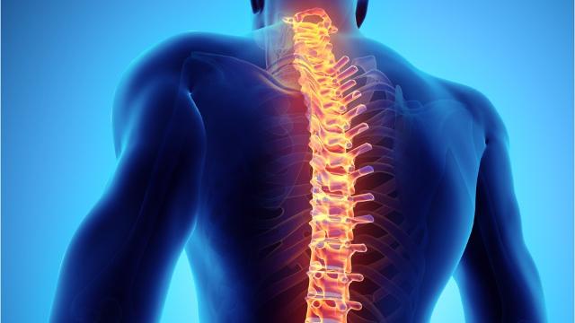 Spinal Cord Injury Treatment in Iran