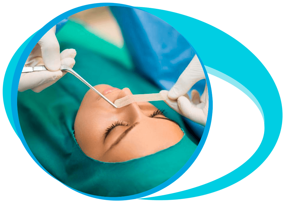 Turbinate Reduction Nasal (turbinectomy) Surgery in Iran