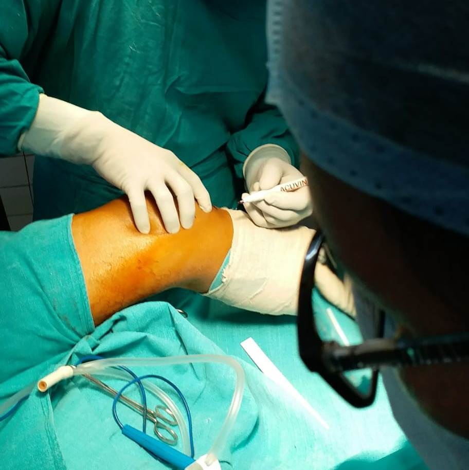 Arthroscopic Surgery in Iran