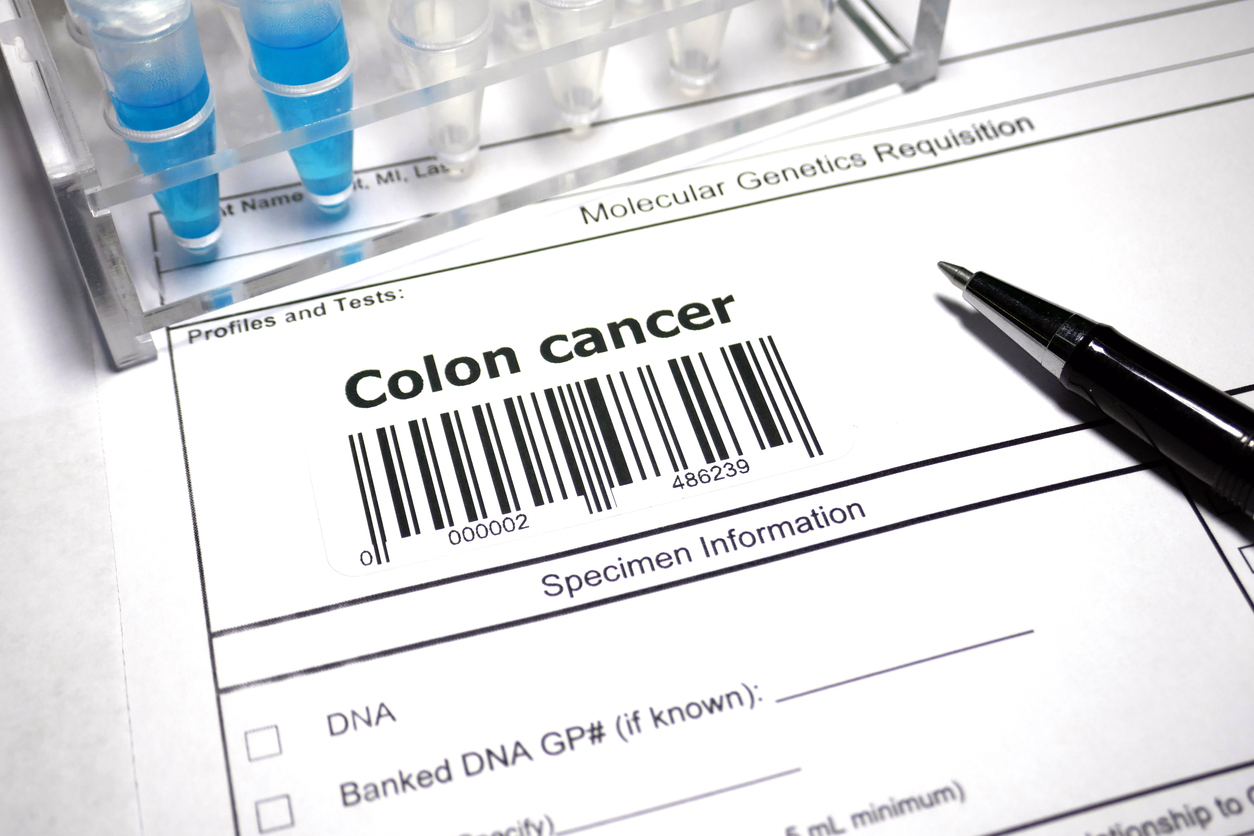 Colon Cancer Treatment in Iran