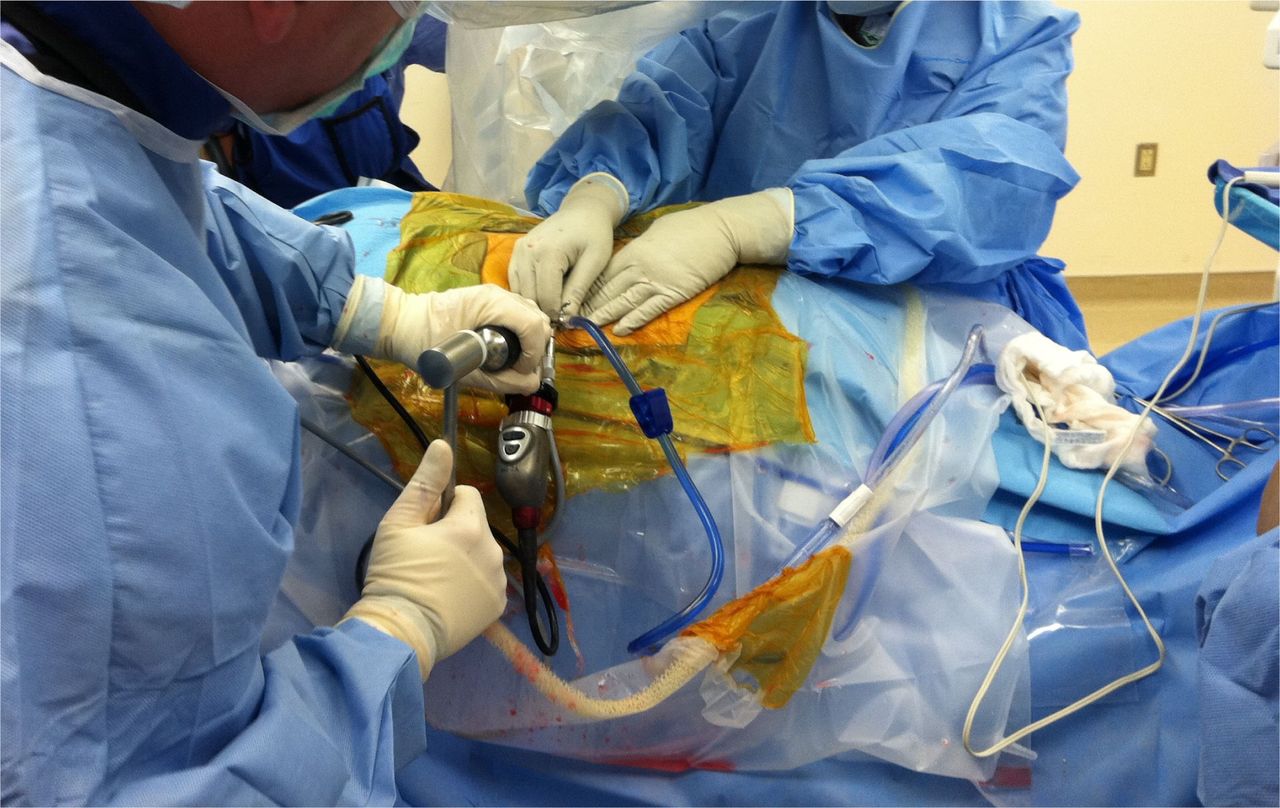 Endoscopic Surgery in Iran