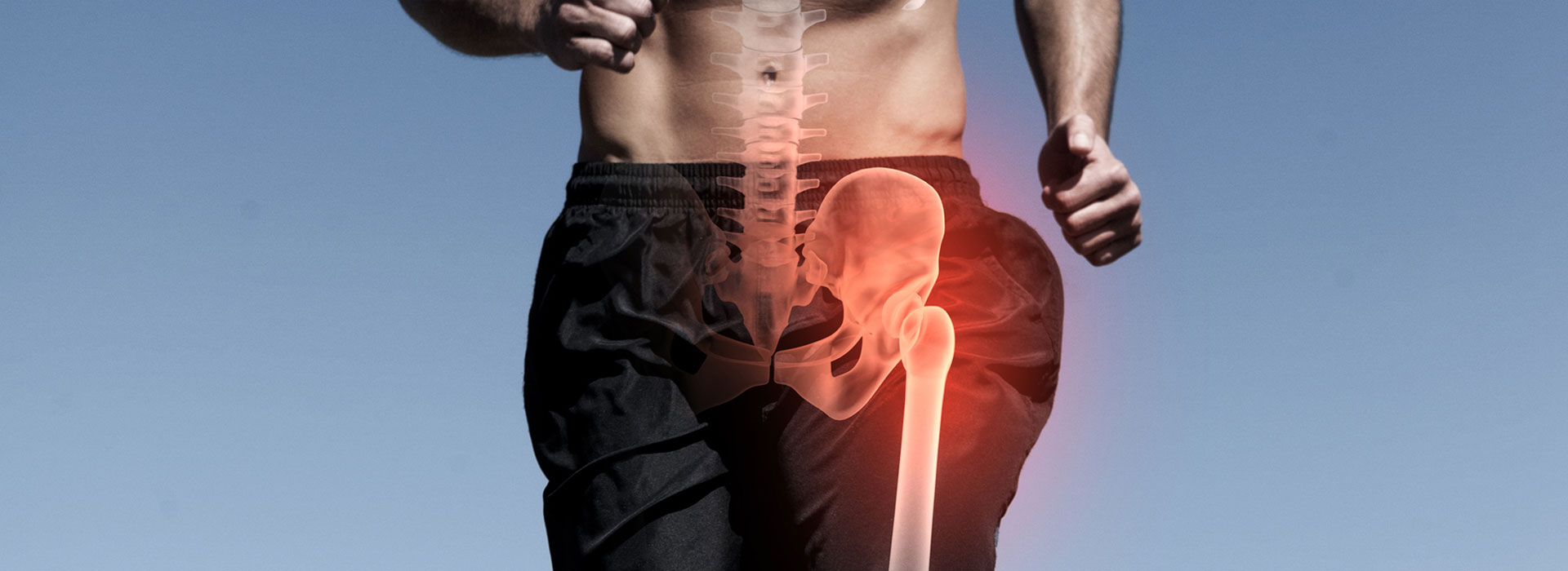 Hip Replacement Surgery in Iran