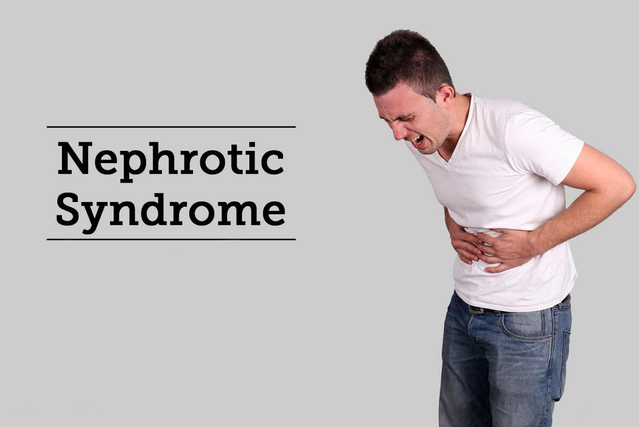 Nephrotic Syndrome Treatment in Iran 