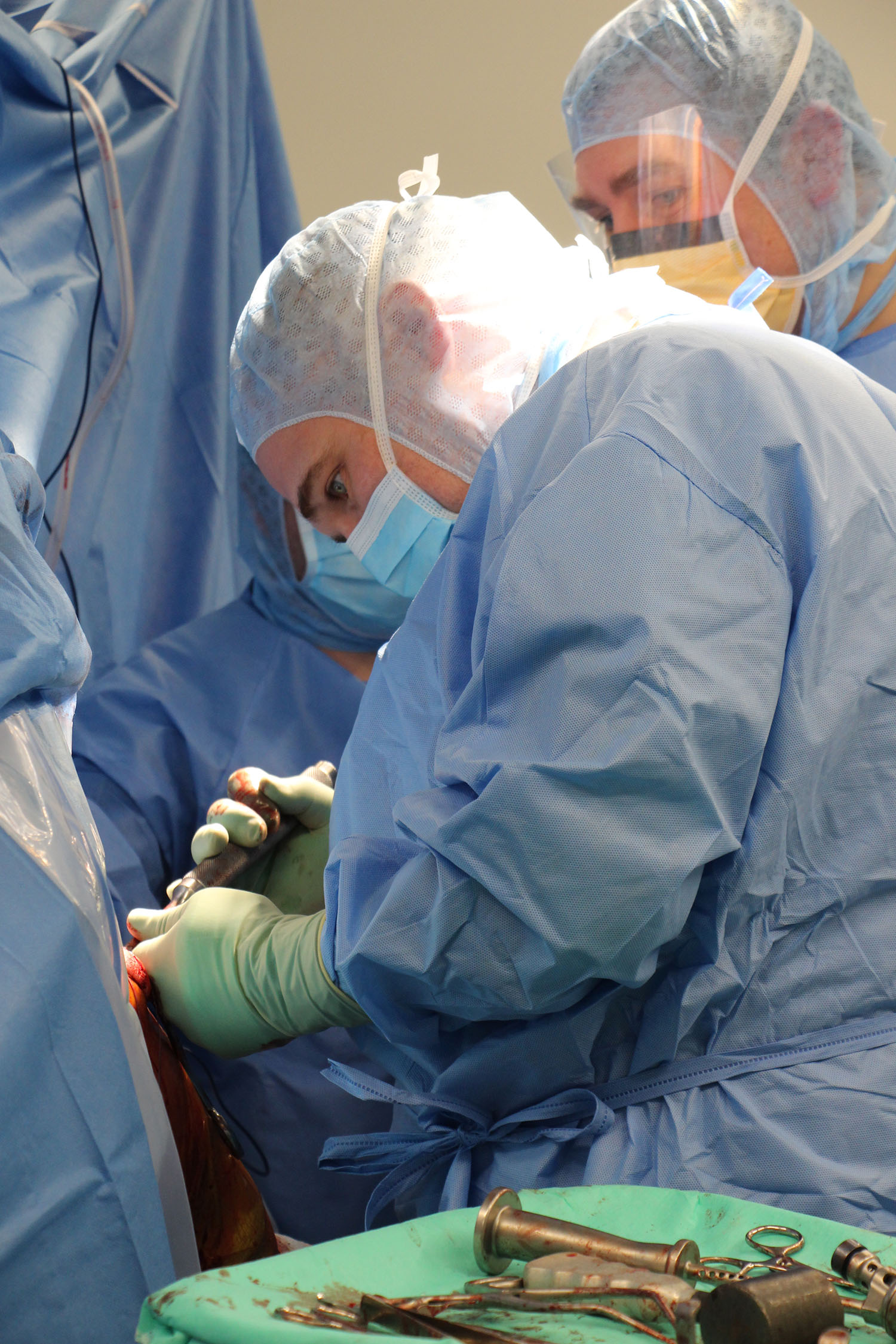 Shoulder Surgery in Iran 