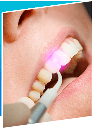 Laser Dental Treatments