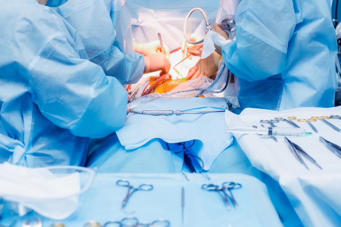 Endometriosis laparoscopy in Iran
